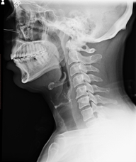 Book an Appointment with Dr. Wild - Exam/Report for Chiropractic